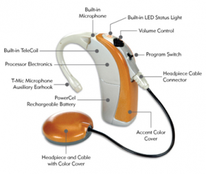 Cochlear implant (External component – behind the ear processor)